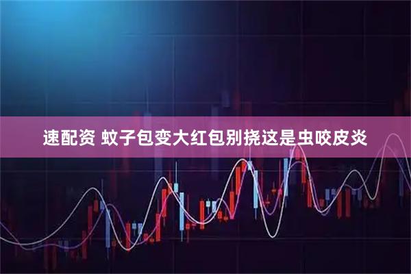 速配资 蚊子包变大红包　别挠这是虫咬皮炎